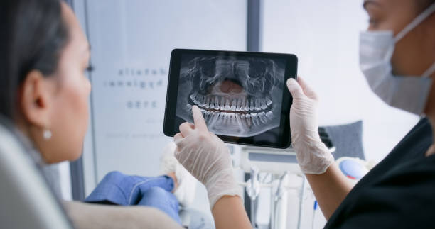 Licensed Tooth Extraction service in Old Fig Garden, CA - Smile Center Dentistry